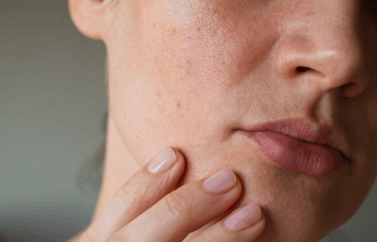 Việc sử dụng các thiết bị sưởi ấm trong nhà như máy sưởi, lò đốt hoặc điều hòa cũng khiến không khí khô hơn, khiến da dễ nứt nẻ nếu không được chăm sóc đầy đủ.